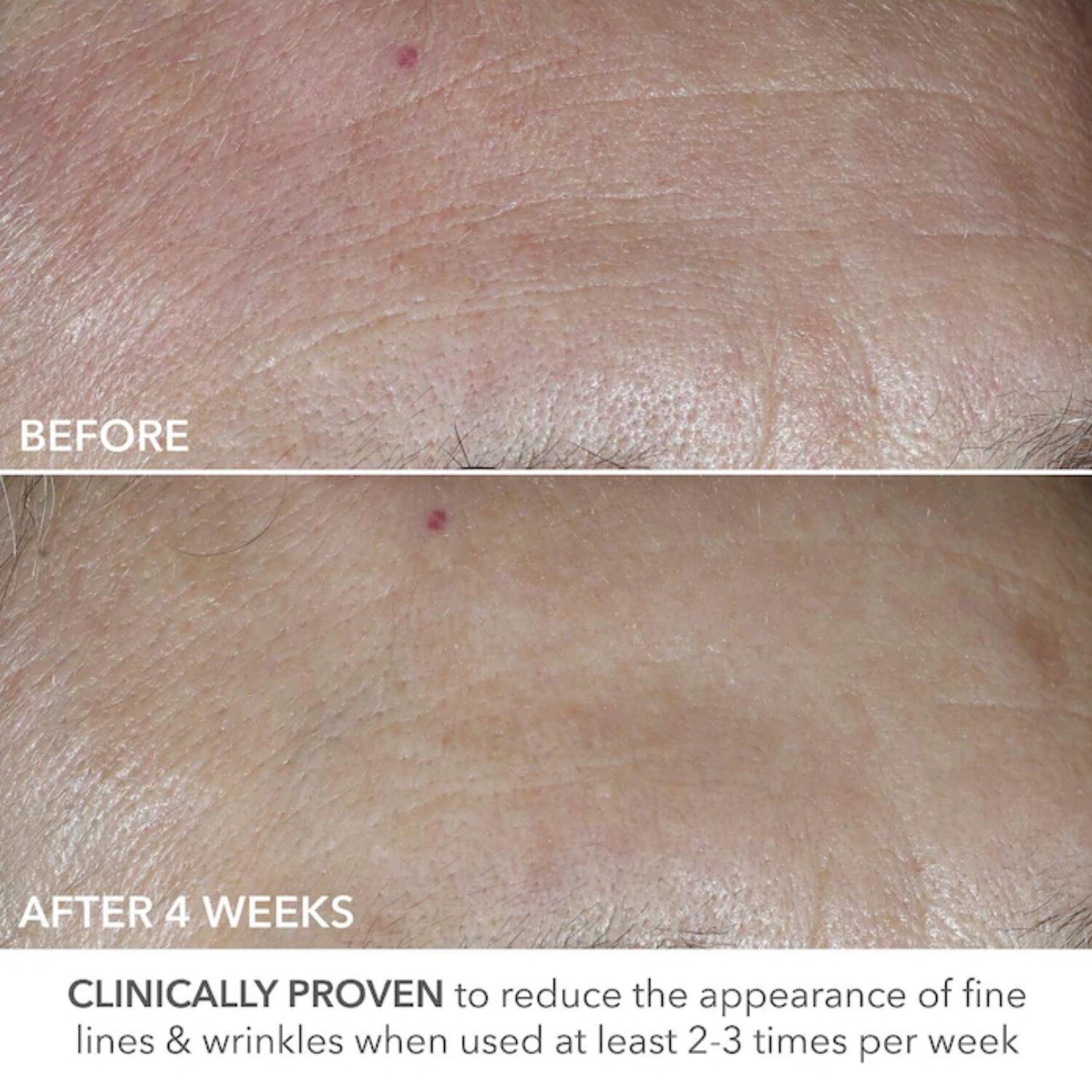 ADVANCED RETINOL + FERULIC PERFECTLY DOSED RETINOL UNIVERSAL 0.2% (ALMOHADILLAS EXFOLIANTES CON RETINOL)